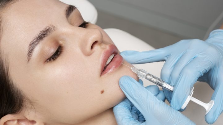 How Long Does It Take For Lip Fillers To Heal?